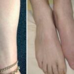 https://chronicillness.co/