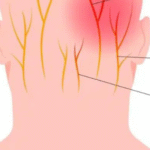 https://chronicillness.co/