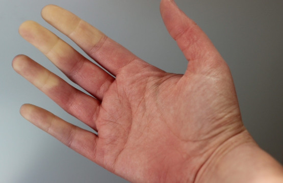 https://chronicillness.co/