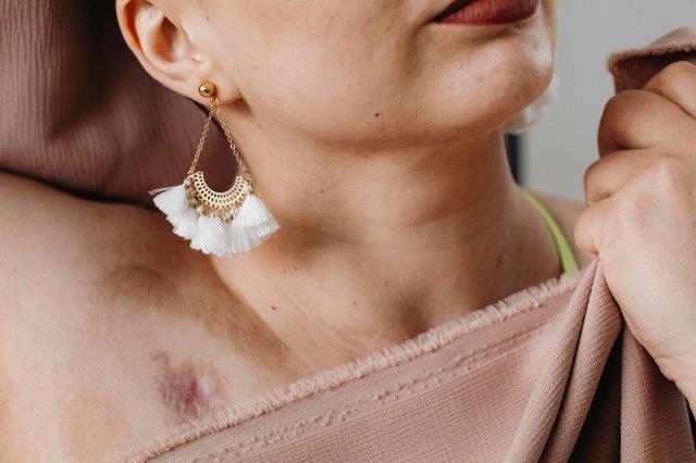 https://chronicillness.co/