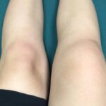 https://chronicillness.co/
