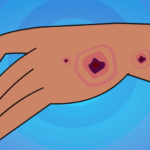 https://chronicillness.co/