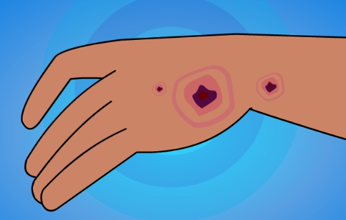 https://chronicillness.co/