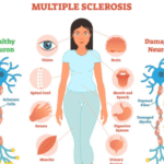 https://chronicillness.co/
