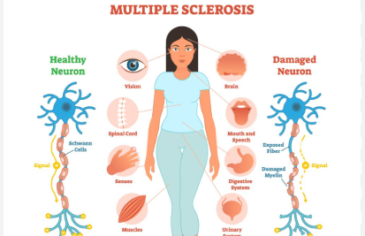 https://chronicillness.co/